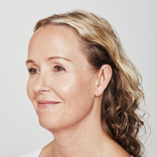 Dysport | ﻿﻿Irvine Medical Spa | New