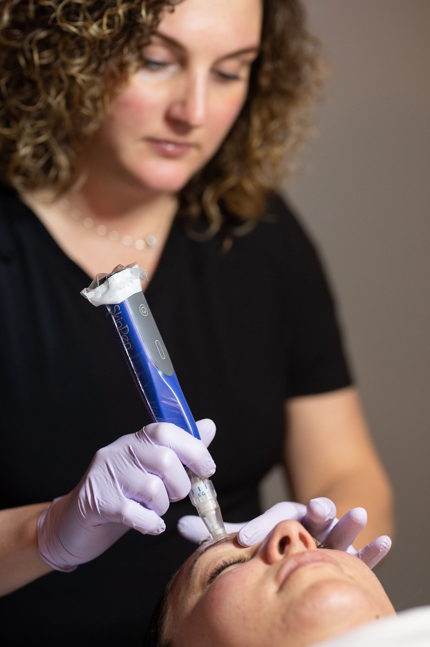 Microneedling